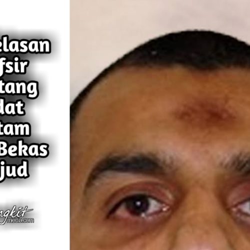 Penjelasan Tafsir tentang Jidat Hitam dan Bekas Sujud